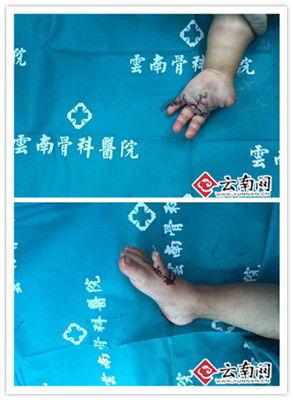 五根手指全集在线观看,指尖上的情感交响曲